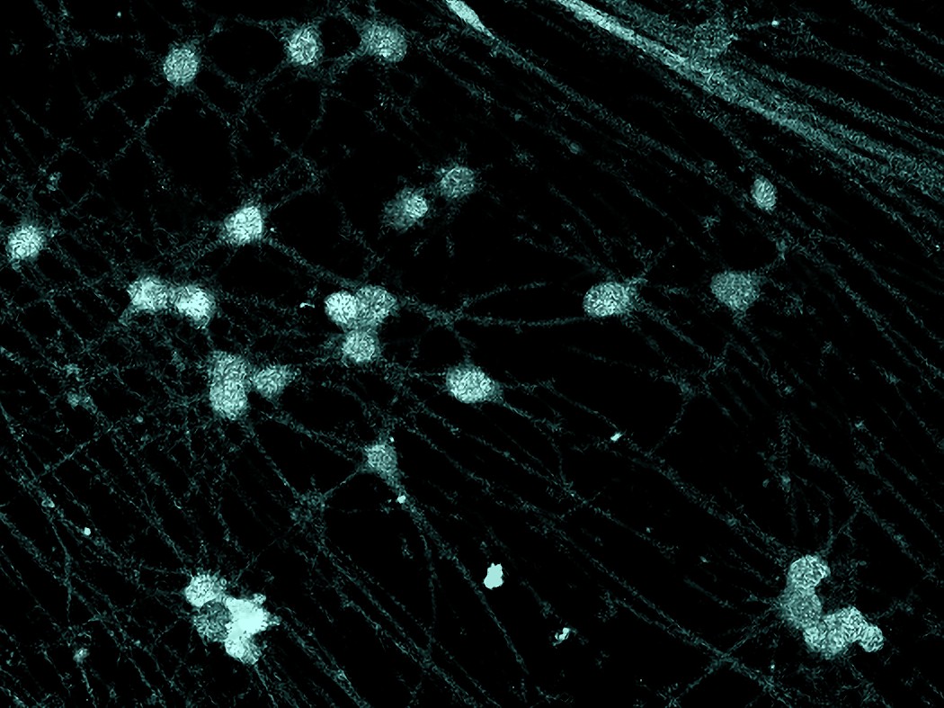 Cultured human sensory neurons with cell bodies and axons in teal and nuclei in gray