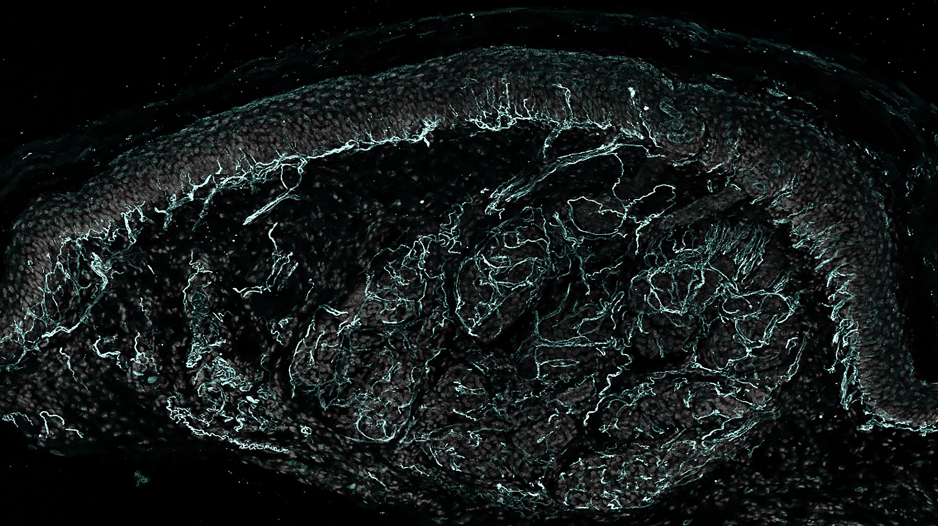Section of skin with sensory nerve fibers in teal and cell nuclei in gray