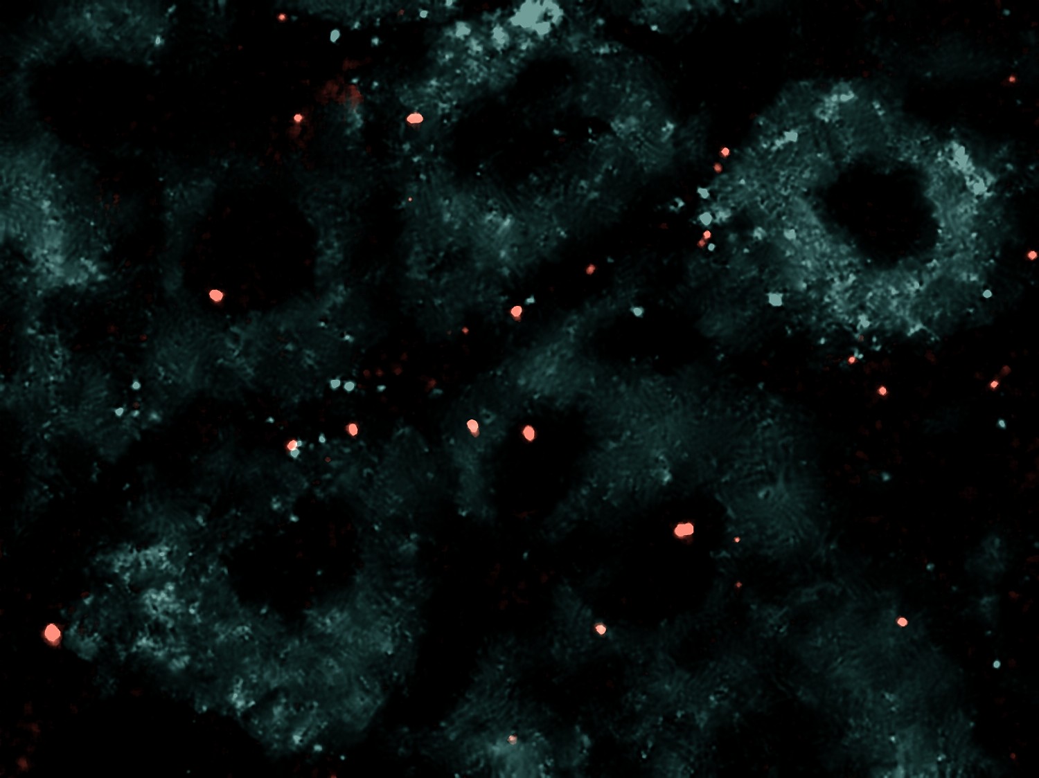 Dorsal root ganglion with engineered human T cells in red among neurons in teal